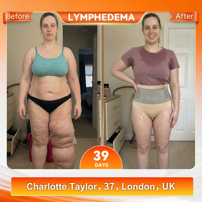 𝐄𝐥𝐫о𝐬𝐨𝐲® 🇬🇧𝐌𝐨𝐫𝐢𝐧𝐠𝐚 & 𝐁𝐞𝐫𝐛𝐞𝐫𝐢𝐧𝐞 🩰 4-𝐈𝐧-1 𝐌𝐢𝐜𝐫𝐨-𝐏𝐚𝐫𝐭𝐢𝐜𝐥𝐞 𝐒𝐜𝐮𝐥𝐩𝐭𝐢𝐧𝐠 & 𝐅𝐚𝐭-𝐁𝐮𝐫𝐧 𝐒𝐡𝐨𝐫𝐭𝐬⚡