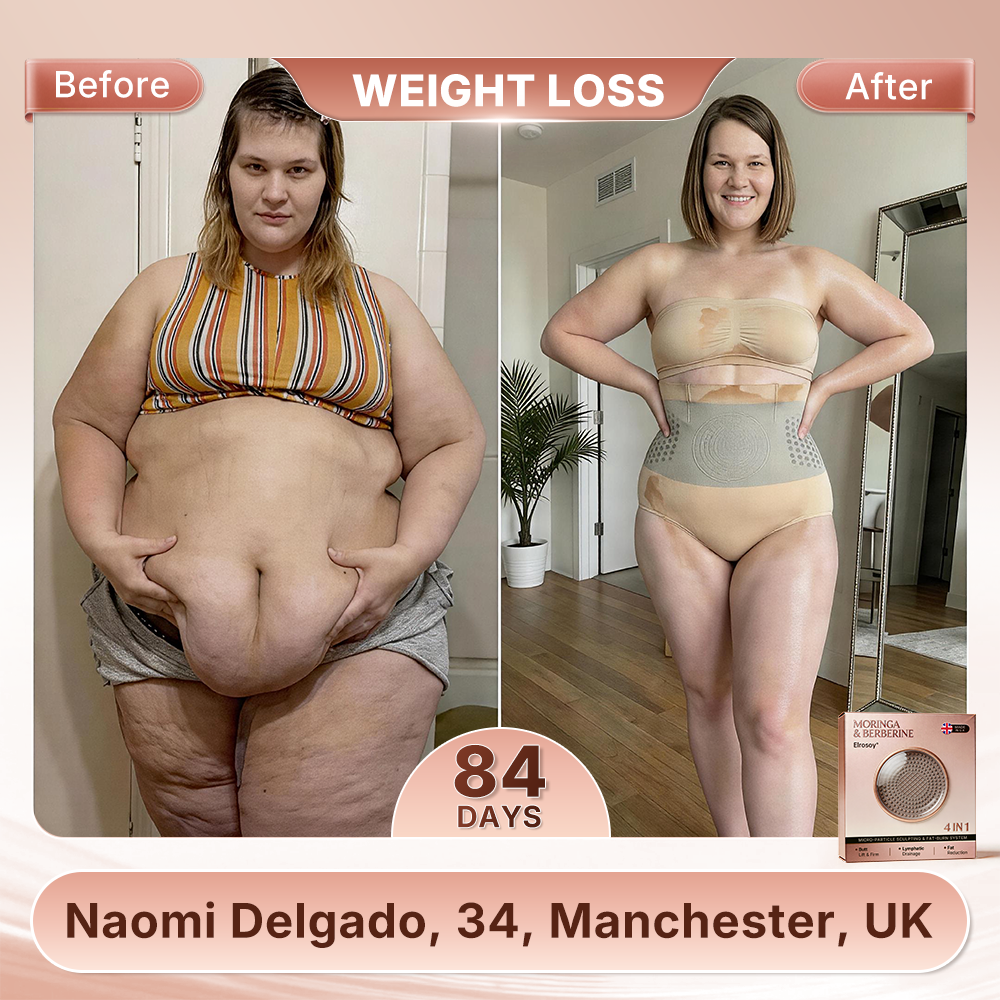 𝐄𝐥𝐫о𝐬𝐨𝐲® 🇬🇧𝐌𝐨𝐫𝐢𝐧𝐠𝐚 & 𝐁𝐞𝐫𝐛𝐞𝐫𝐢𝐧𝐞 👨‍⚕️ 4-𝐈𝐧-1 𝐌𝐢𝐜𝐫𝐨-𝐏𝐚𝐫𝐭𝐢𝐜𝐥𝐞 𝐒𝐜𝐮𝐥𝐩𝐭𝐢𝐧𝐠 & 𝐅𝐚𝐭-𝐁𝐮𝐫𝐧 𝐒𝐡𝐨𝐫𝐭𝐬📢