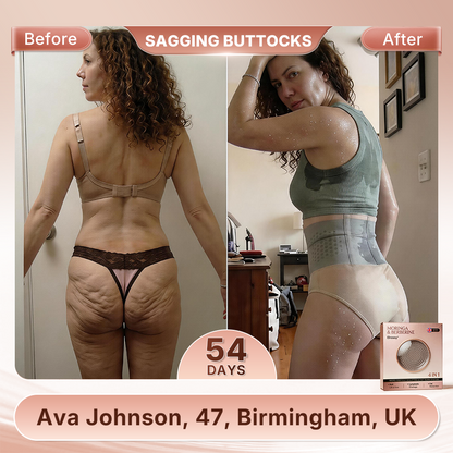 𝐄𝐥𝐫о𝐬𝐨𝐲® 🇬🇧𝐌𝐨𝐫𝐢𝐧𝐠𝐚 & 𝐁𝐞𝐫𝐛𝐞𝐫𝐢𝐧𝐞 👨‍⚕️ 4-𝐈𝐧-1 𝐌𝐢𝐜𝐫𝐨-𝐏𝐚𝐫𝐭𝐢𝐜𝐥𝐞 𝐒𝐜𝐮𝐥𝐩𝐭𝐢𝐧𝐠 & 𝐅𝐚𝐭-𝐁𝐮𝐫𝐧 𝐒𝐡𝐨𝐫𝐭𝐬📢